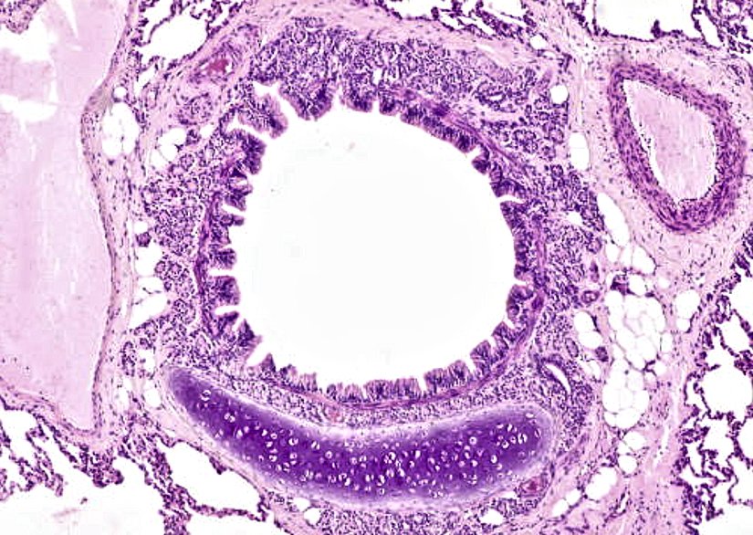 secondary bronchus histology